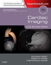 Cardiac Imaging
